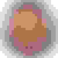 Malcom had oral surgery at Oral Surgery Group