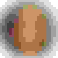 Melissa had oral surgery at Oral Surgery Group