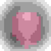 Melissa had oral surgery at Oral Surgery Group