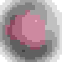 Richie had oral surgery at Oral Surgery Group