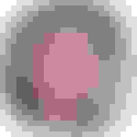 Rob had oral surgery at Oral Surgery Group