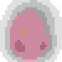 Mandy wisdom teeth  facewall