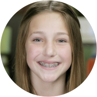 Clare got braces in Fresno, CA