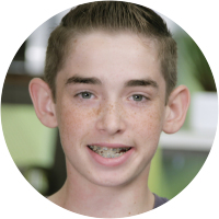 Jonathan got braces in Fresno, CA