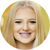 Jordan got braces in Clovis, CA