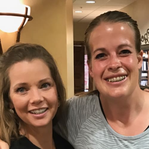 Facial reconstruction 2015 10