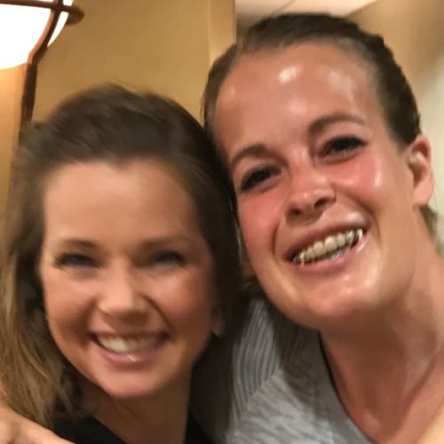 Facial reconstruction 2015 9