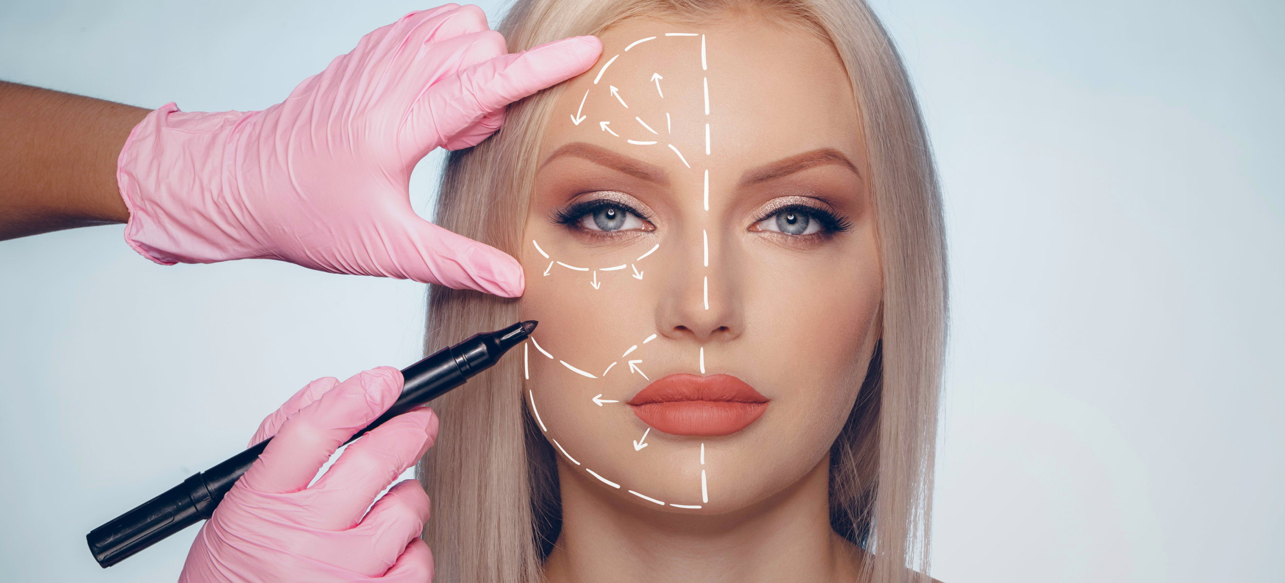 woman with with face markings preparing for plastic surgery