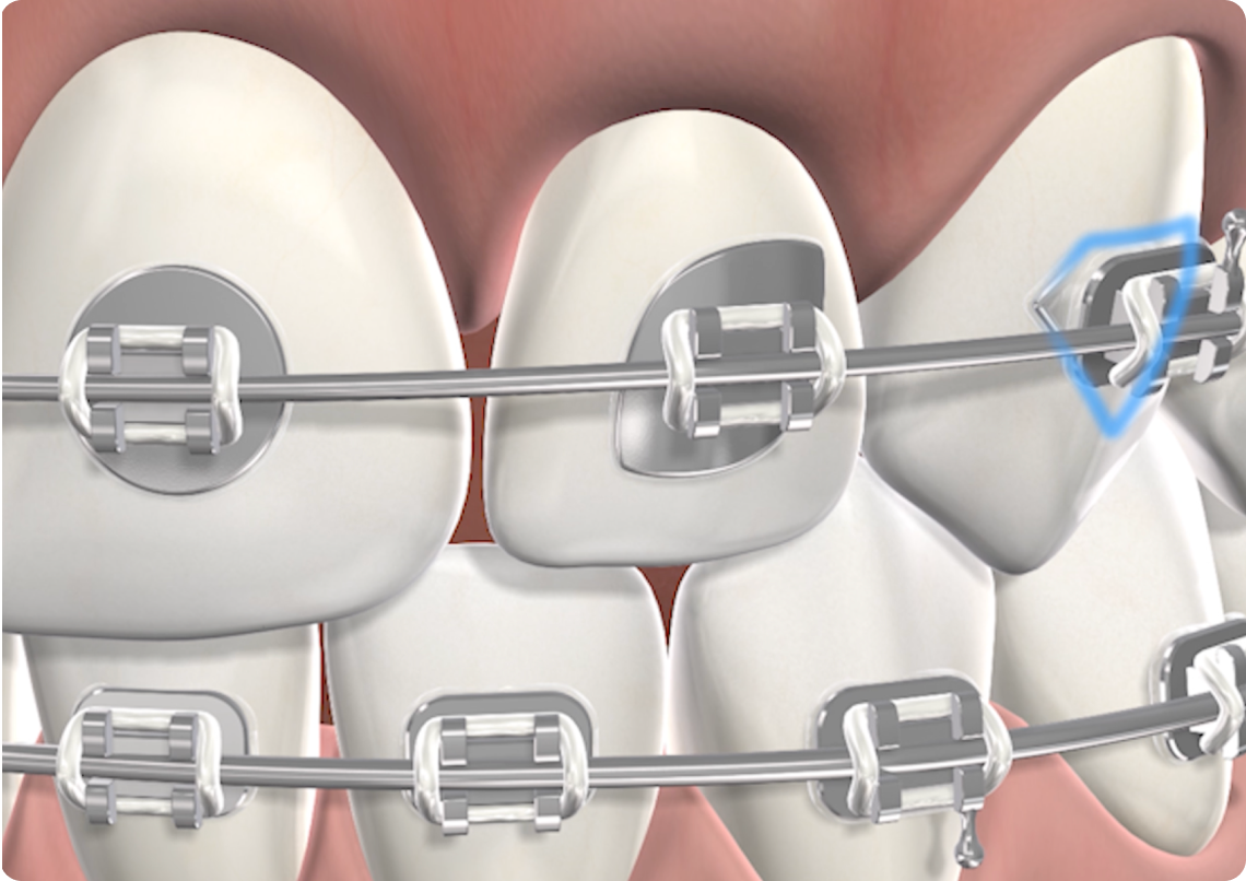 Stemodontics 3d image rendering