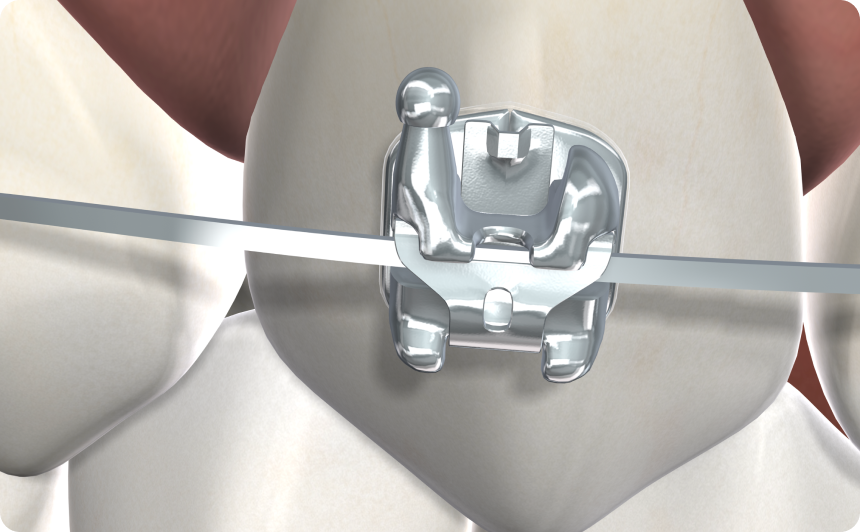 Stemodontics 3d image rendering 2