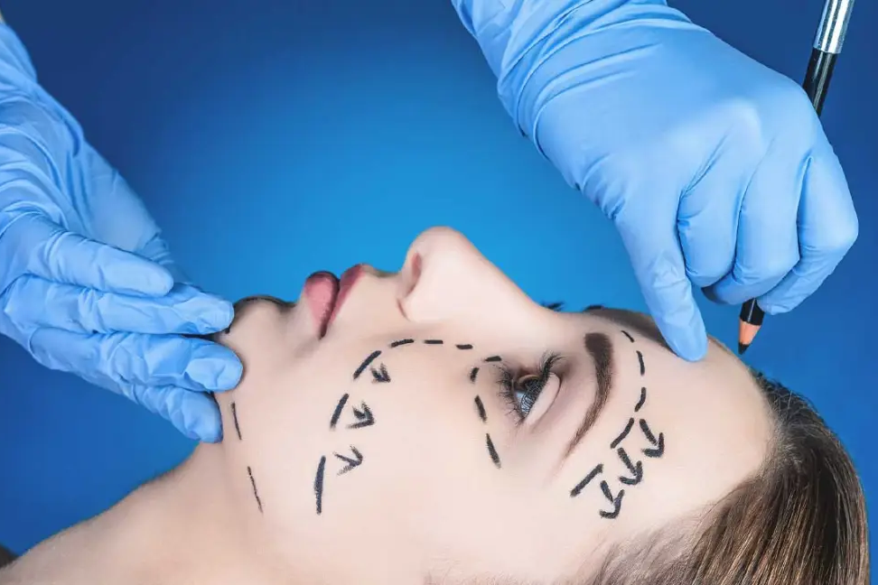 woman with with face markings preparing for plastic surgery