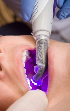 Amalgam and Amalgam separators