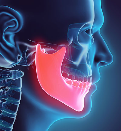 Image of a human jaw at Madison Oral Surgery & Dental Implants in Madison, WI.