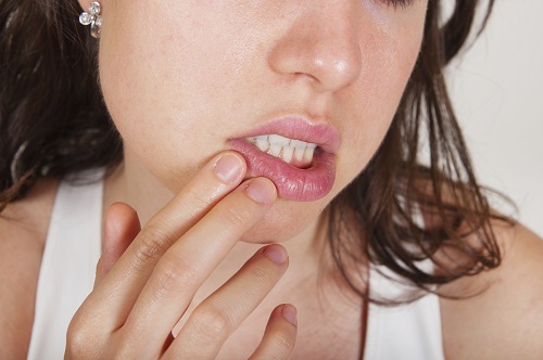 Woman pressing her hand against the side of her mouth at Madison Oral Surgery & Dental Implants
