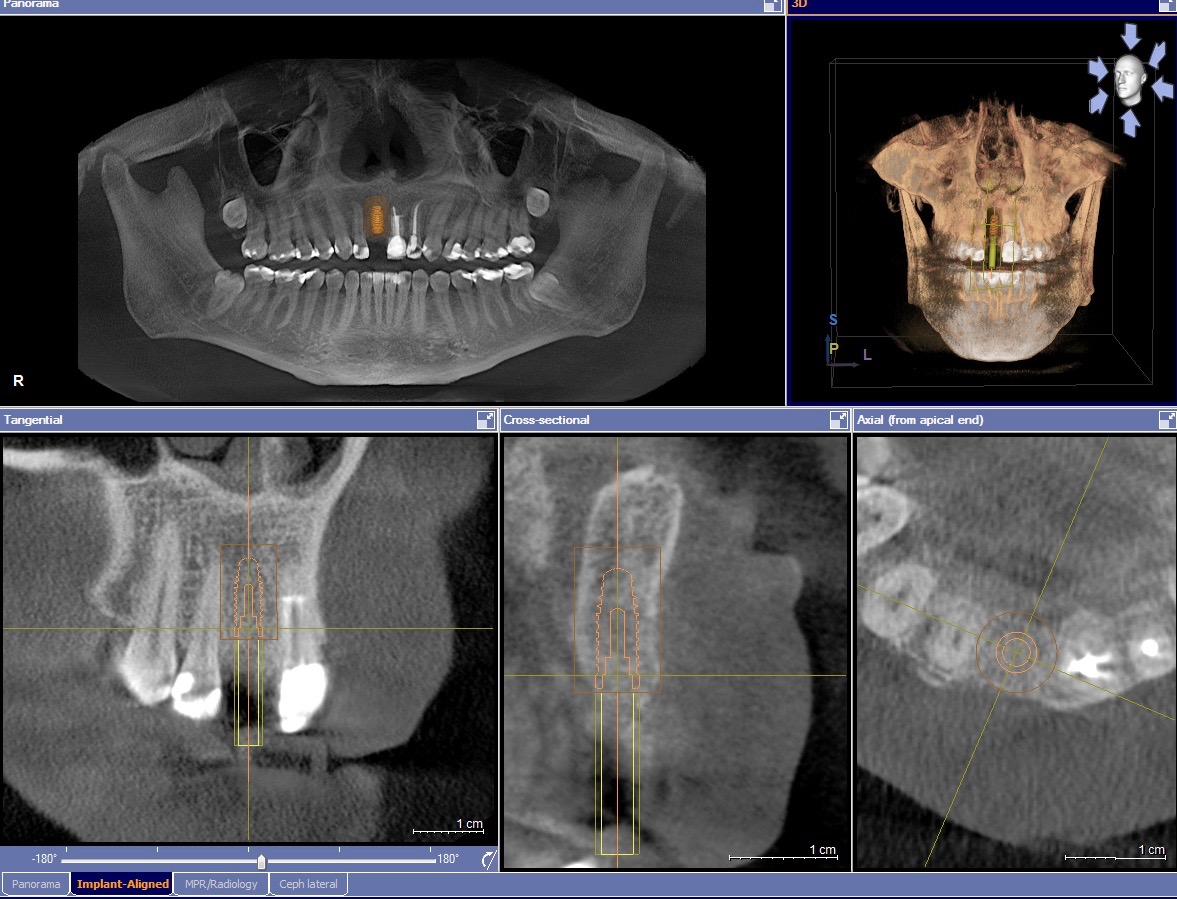 Oral Surgery Services 3D Scanning