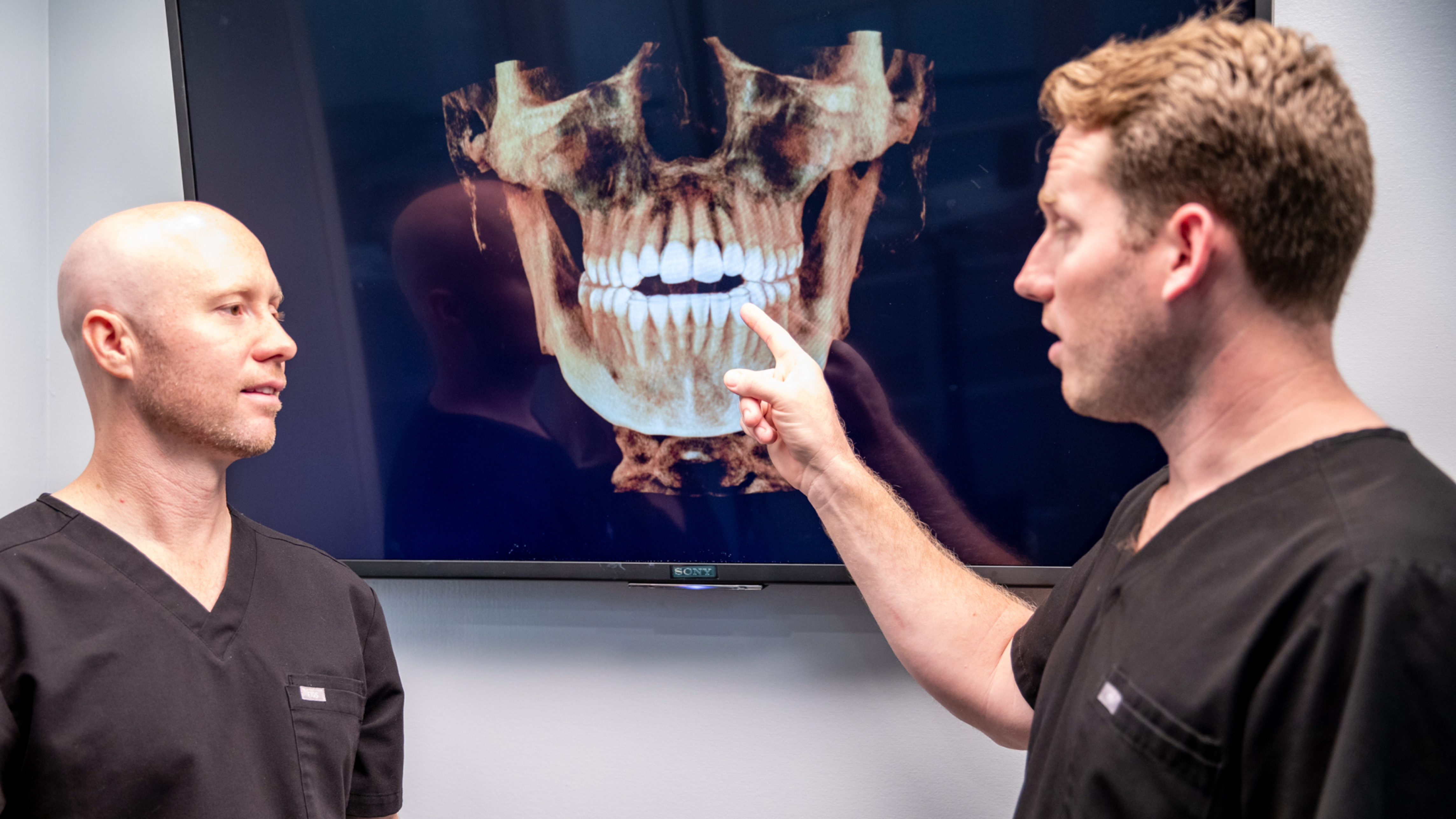 hyperdontia skull