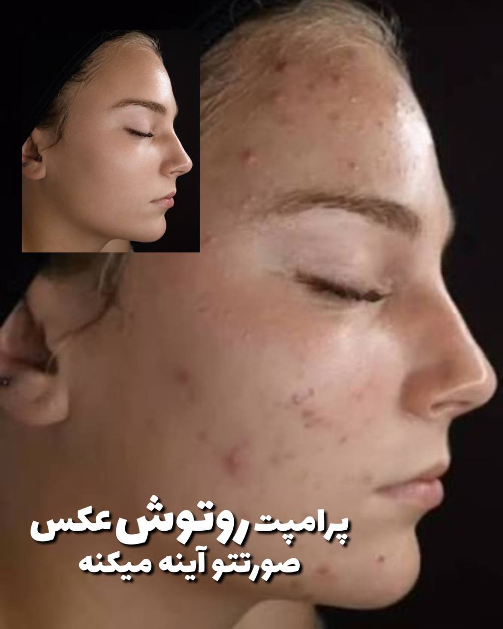 تصویر پرامپت روتوش حرفهای پوست | PromptsFA