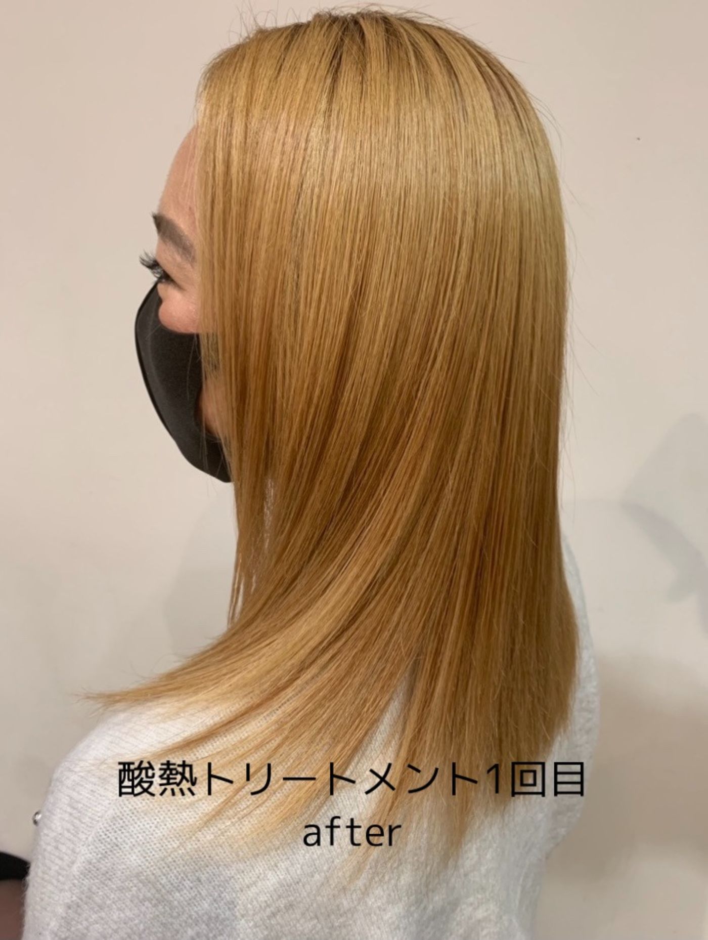 酸熱トリートメント1回目after