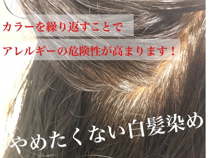 アレルギー予防 美容院に行った後頭皮が痒くなることありませんか カラー パーマ コラム 美容室 Nyny 大久保店 松佐 友香梨 ヘアサロン 美容院 ニューヨークニューヨーク アレルギー予防 美容院に行った後頭皮が痒くなることありませんか カラー パーマ コラム 美容室 Nyny 大久保店 松佐 友香梨 ヘアサロン 美容院 ニューヨークニューヨーク