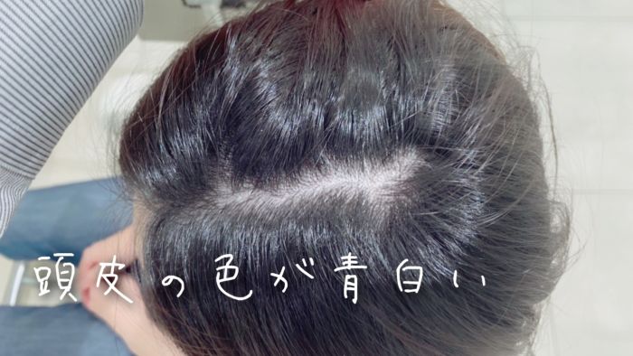 マスク生活の弊害 髪が細く薄くなる原因とその対策 コラム 美容室 Nyny Co なんばパークス店 上田 篤史 ヘアサロン 美容院 ニューヨークニューヨーク マスク生活の弊害 髪が細く薄くなる原因とその対策 コラム 美容室 Nyny Co なんばパークス店 上田 篤史 ヘアサロン 美容院 ニューヨークニューヨーク