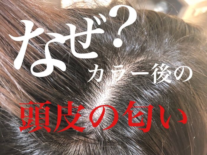 アレルギー予防 美容院に行った後頭皮が痒くなることありませんか カラー パーマ コラム 美容室 Nyny 大久保店 松佐 友香梨 ヘアサロン 美容院 ニューヨークニューヨーク アレルギー予防 美容院に行った後頭皮が痒くなることありませんか カラー パーマ コラム 美容室 Nyny 大久保店 松佐 友香梨 ヘアサロン 美容院 ニューヨークニューヨーク