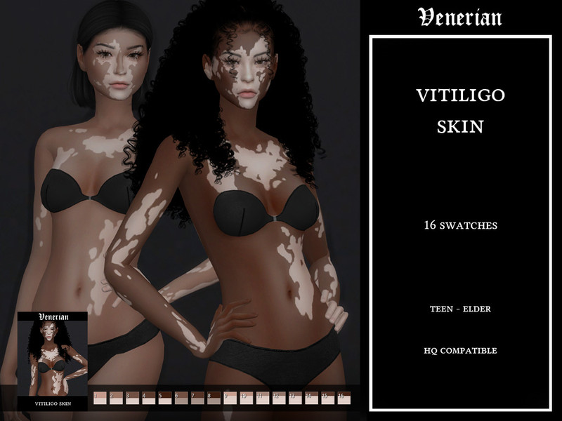 Sims 4 Vitiligo Skin - Female - by Venerian by Venerian