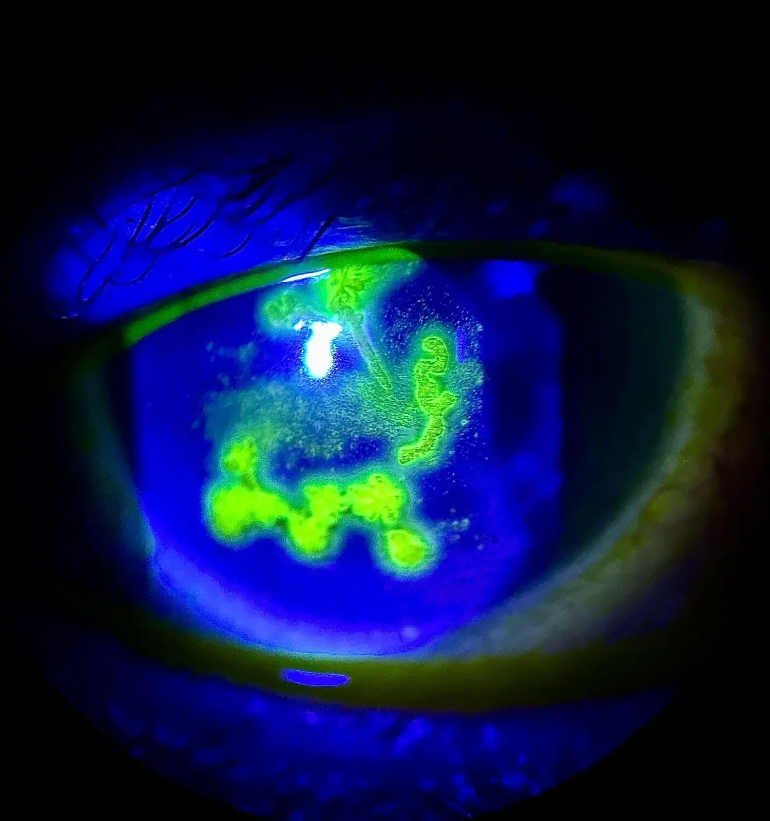 Fluorescein Là Gì? Ứng Dụng Quan Trọng Của Chất Phát Huỳnh Quang Trong Pháp Y