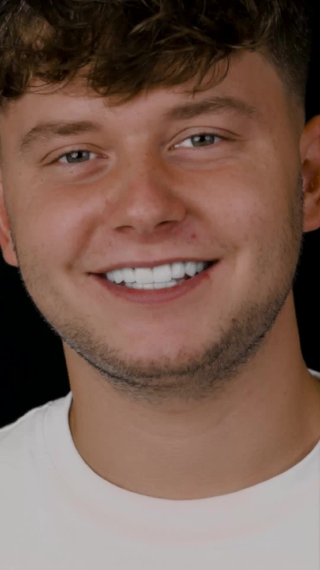 DentGen smile transformation