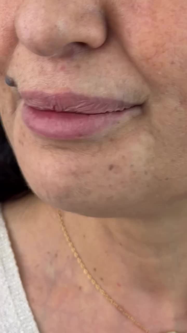 Smile makeover Dubai