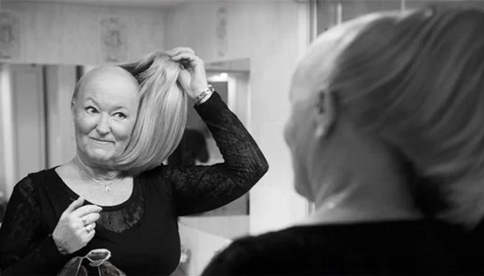 Artikkelbilde - Parykk og hårerstatning