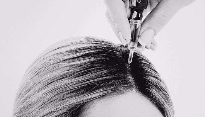 Artikkelbilde - Trikologibehandling