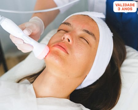 Fotorejuvenescimento Facial a Laser - Tecnologia Avançada | Clínicas Monisa em Vila Real