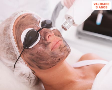 Limpeza de Rosto com Peeling de Carbono + Massagem Facial | Avenida de Berna