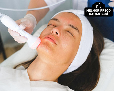 Fotorejuvenescimento Facial a Laser - Tecnologia Avançada | Clínicas Monisa em Vila Real