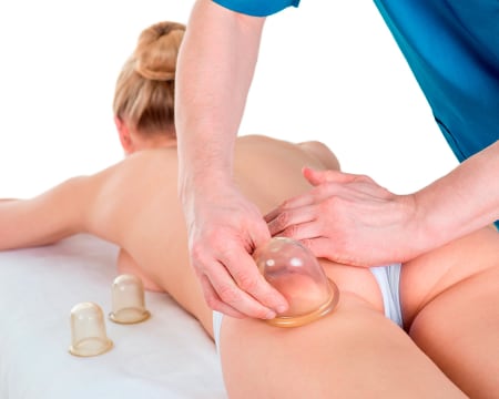 Solário Morena Pimenta | Massagem Terapêutica com Ventosas no Corpo Inteiro