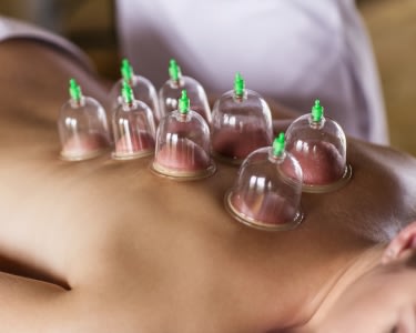 Massagem com Ventosas a 2 | NBfisio Estoril Massagem com Ventosas a 2 | NBfisio Estoril