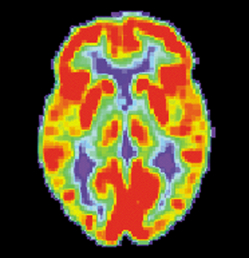 brain