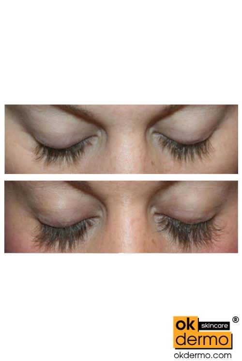 Lumigan® Eyelash Growth Serum 3ml [Bimatoprost 0.03 Drops] OKDERMO®