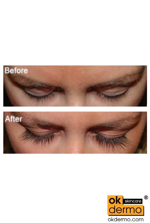 Lumigan® Eyelash Growth Serum 3ml [Bimatoprost 0.03 Drops] OKDERMO®