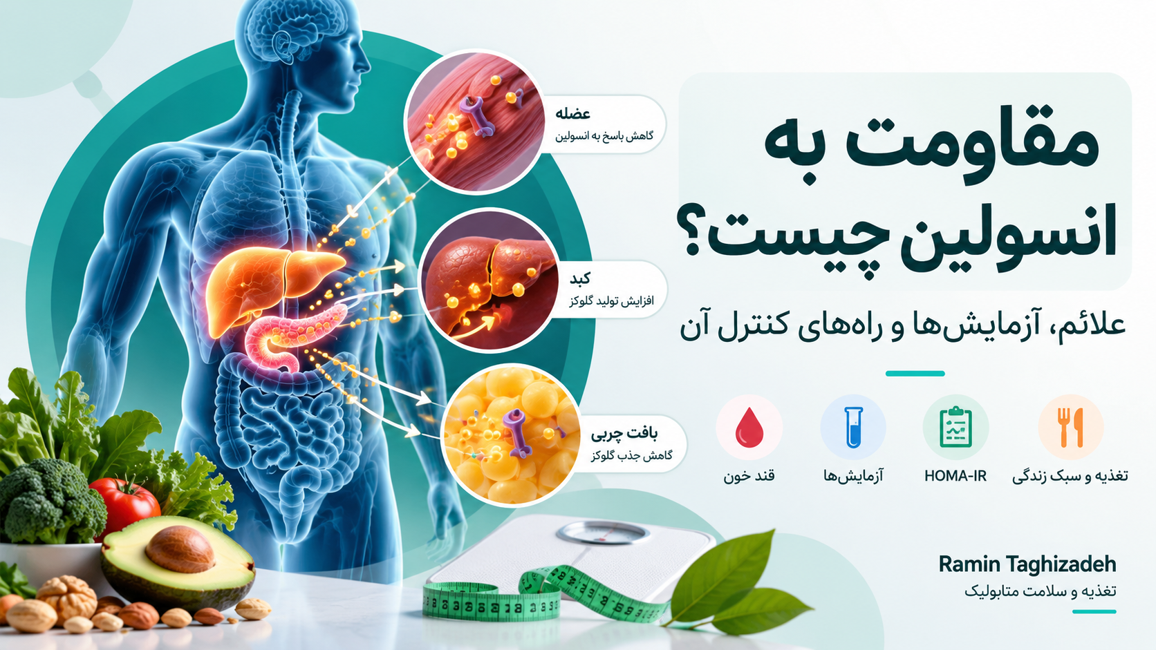 مقاومت به انسولین چیست؟ علائم، آزمایشها و راههای کنترل آن