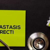 causes-of-diastasis-recti-and-its-treatment