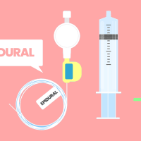 epidural-safe-or-risky