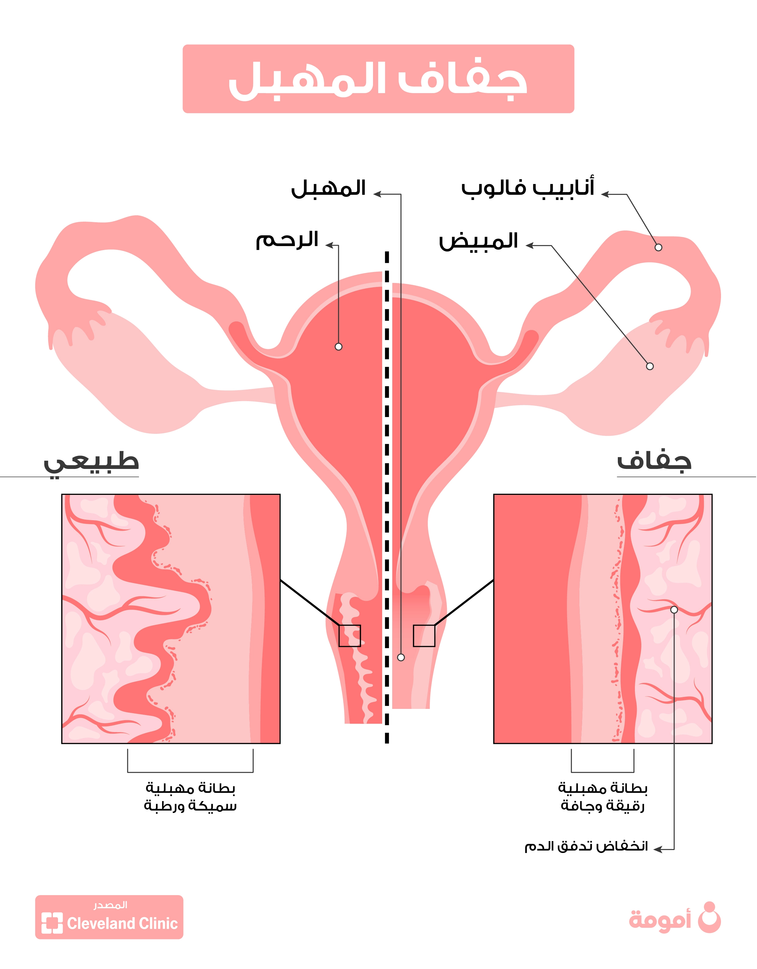  اسباب جفاف المهبل 