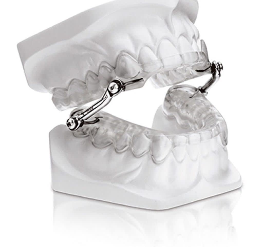 What Is a Herbst Sleep Appliance? Sleep Doctor