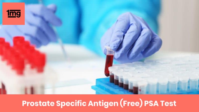 Prostate Specific Antigen (Free) PSA