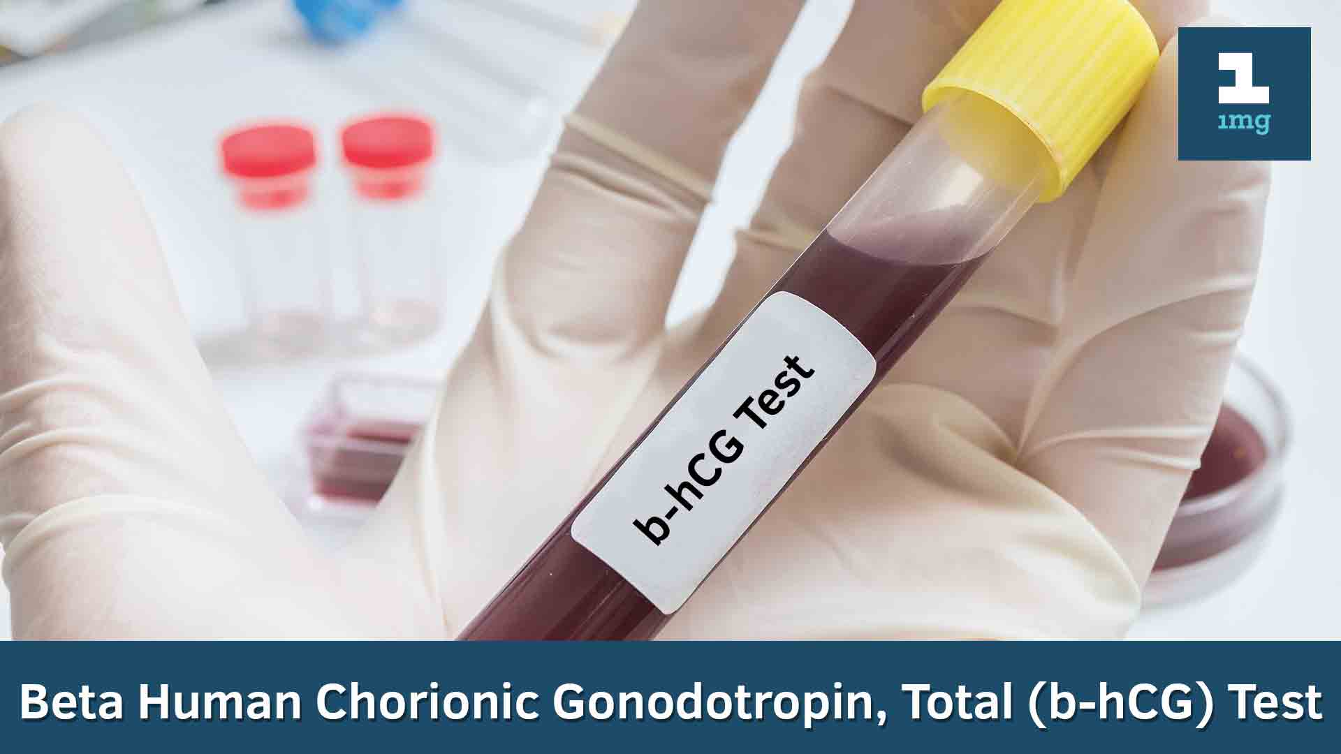 Beta Human Chorionic Gonodotropin, Total