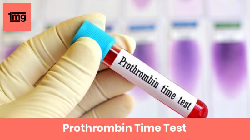 Prothrombin Time