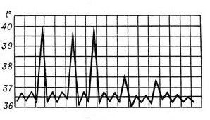 Febris Intermittens