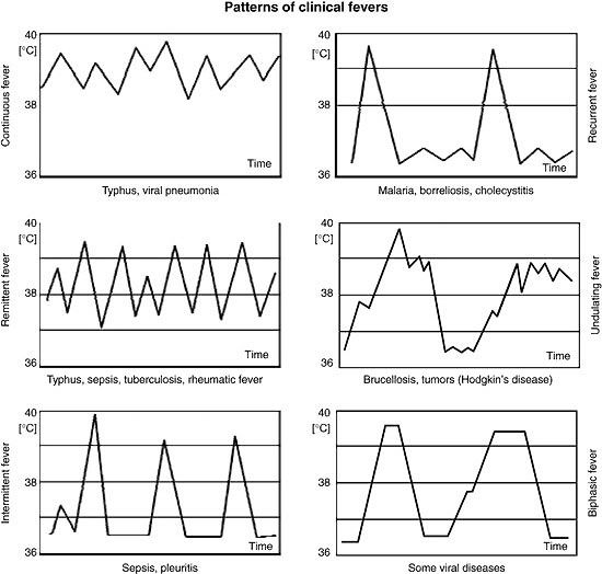 Patterns of clincical fevers