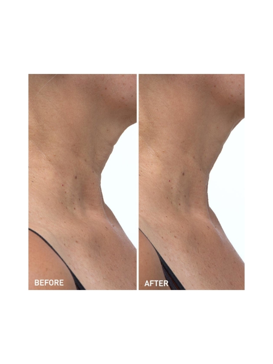 SKYN ICELAND - Hydro Cool Firming Neck Gels -silottavat kaulanaamiot 4kpl - photo 3 SKYN ICELAND - Hydro Cool Firming Neck Gels -silottavat kaulanaamiot 4kpl | Stockmann - photo 3